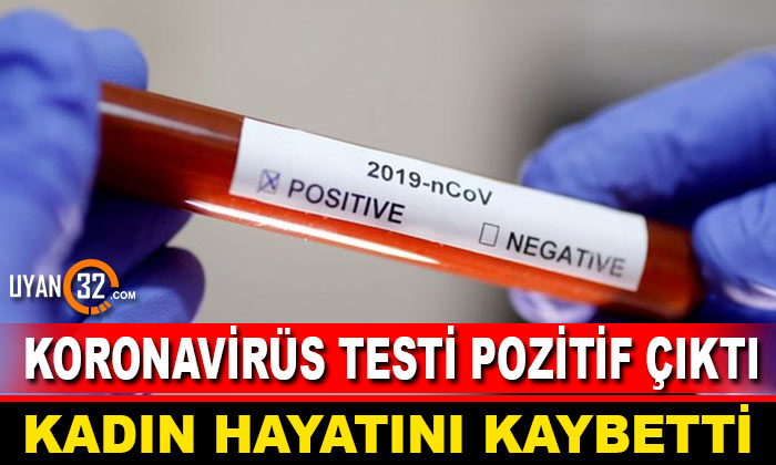 Koronavirüs Testi Pozitif Çıktı, Hayatını Kaybetti
